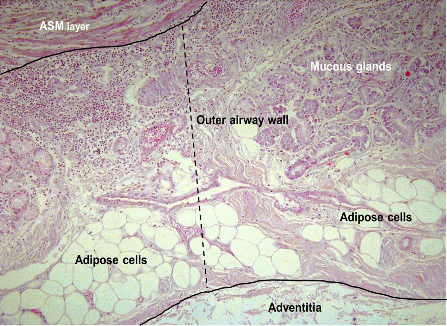 Histones and Lysine